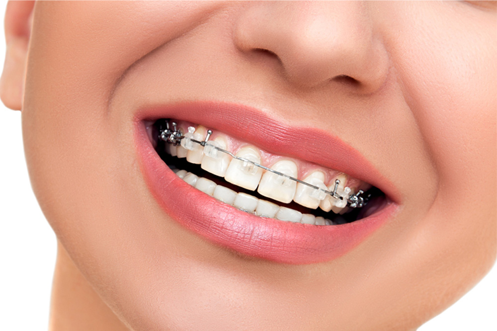 ortodoncja-cos-szczecin